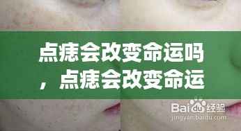 星座运势下的皮肤小手术,点痣能否改变命运?