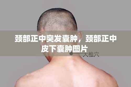 望其项背 第3页