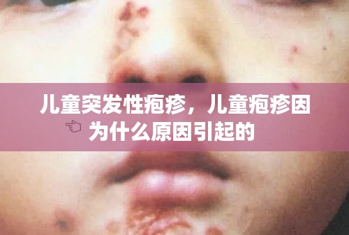 儿童突发性疱疹,儿童疱疹因为什么原因引起的
